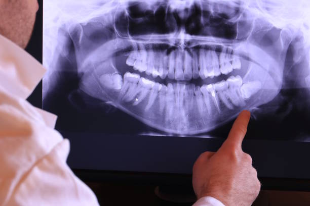 Best Emergency Treatment for Dental Infections or Abscesses in Waukegan, IL