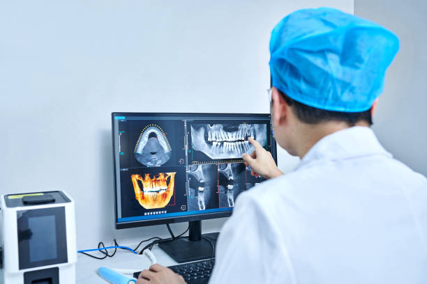 Best Emergency Root Canal Treatment in Waukegan, IL
